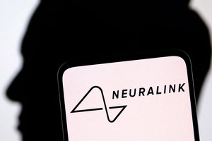 Neuralink ko‘rish qobiliyatini tiklash uchun implant sinovlarini boshlaydi