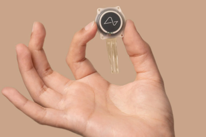“Neuralink” kompaniyasi uchinchi bemorning miyasiga chip o‘rnatdi