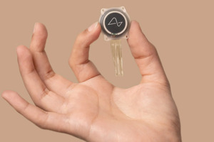 Neuralink chipi o‘rnatilgan bemorda birinchi muammolar paydo bo‘ldi