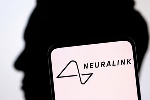 Илон Маск сообщил о восстановлении первого пациента с чипом Neuralink