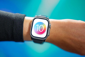 Yangi Apple Watch Series 10 qon bosimini o‘lchash imkoniyatiga ega bo‘ladi