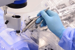 Ko‘z to‘r pardasida mustaqil operatsiyalar o‘tkazish uchun robot ishlab chiqildi