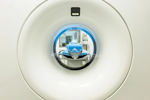 Sun’iy intellekt MRT skanerlash vaqtini 23 daqiqadan 9 daqiqagacha qisqartirdi